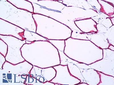 Anti-PTRF antibody IHC of human breast, adipocytes. Immunohistochemistry of formalin-fixed, paraffin-embedded tissue after heat-induced antigen retrieval. Antibody LS-B7197 concentration 5 ug/ml.