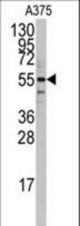 Western blot of anti-PTRF Antibody in A375 cell line lysates (35 ug/lane). PTRF(arrow) was detected using the purified antibody.