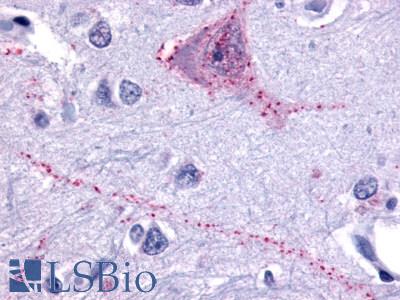 Anti-TACR3 antibody LS-A4043 IHC of human brain, neurons and glia. Immunohistochemistry of formalin-fixed, paraffin-embedded tissue after heat-induced antigen retrieval.
