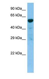 TACR3 / NK3R antibody Western Blot of NCI-H226.
