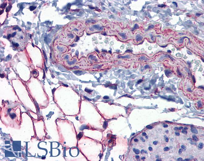 Anti-PTRF antibody IHC of mouse vessel and adipocytes. Immunohistochemistry of formalin-fixed, paraffin-embedded tissue after heat-induced antigen retrieval. Antibody LS-B5629 concentration 5 ug/ml.
