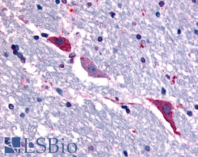 Anti-TACR3 antibody LS-A4147 IHC of human brain, hippocampus. Immunohistochemistry of formalin-fixed, paraffin-embedded tissue after heat-induced antigen retrieval.