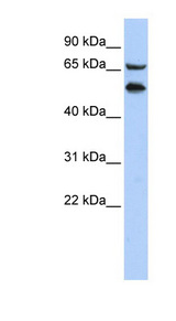 TADA2A / TADA2L antibody LS-C101675 Western blot of HepG2 cell lysate.
