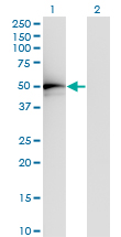 Western Blot analysis of TADA2L expression in transfected 293T cell line by TADA2L monoclonal antibody (M01), clone 4A8-1A7.Lane 1: TADA2L transfected lysate (Predicted MW: 51.5 KDa).Lane 2: Non-transfected lysate.