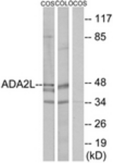Western blot of extracts from COS7/COLO205 cells, using ADA2L Antibody. The lane on the right is treated with the synthesized peptide.