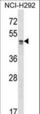TADA2L Antibody western blot of NCI-H292 cell line lysates (35 ug/lane). The TADA2L antibody detected the TADA2L protein (arrow).