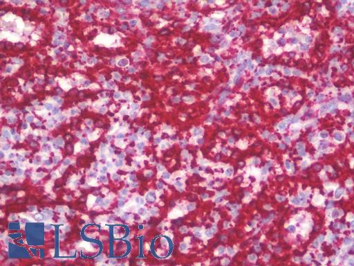 Anti-PTRF / CAVIN antibody IHC staining of human spleen. Immunohistochemistry of formalin-fixed, paraffin-embedded tissue after heat-induced antigen retrieval. Antibody LS-B10088 concentration 10 ug/ml.