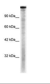 Daudi Cell Lysate