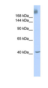 TAF1 antibody LS-C101394 Western blot of Fetal liver lysate.