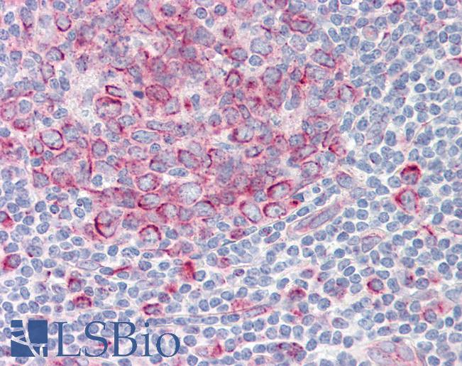 Anti-TAF1 antibody IHC of human tonsil. Immunohistochemistry of formalin-fixed, paraffin-embedded tissue after heat-induced antigen retrieval. Antibody LS-B8406 dilution 5 ug/ml.