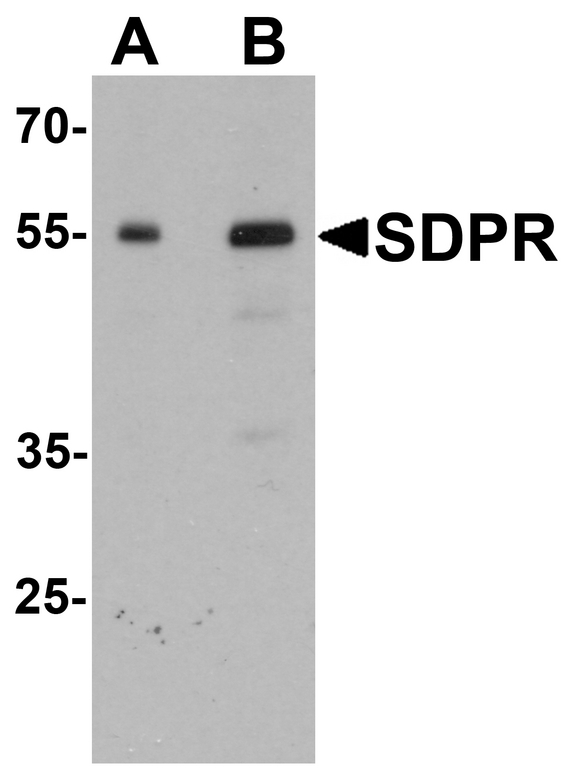 Western blot analysis of PTRF in human spleen tissue lysate with PTRF antibody at (A) 0.5 and (B) 1 ug/ml