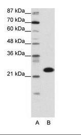 A: Marker, B: Transfected 293T Cell Lysate