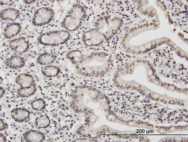 Immunoperoxidase of monoclonal antibody to TAF11 on formalin-fixed paraffin-embedded human small Intestine. [antibody concentration 1.2 ug/ml]