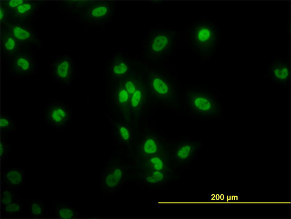 Immunofluorescence of monoclonal antibody to TAF11 on HeLa cell. [antibody concentration 10 ug/ml]