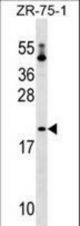 PTRH1 Antibody western blot of ZR-75-1 cell line lysates (35 ug/lane). The PTRH1 antibody detected the PTRH1 protein (arrow).