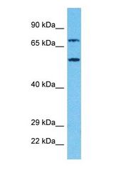Western blot of PRP31 Antibody with human Jurkat Whole Cell lysate.