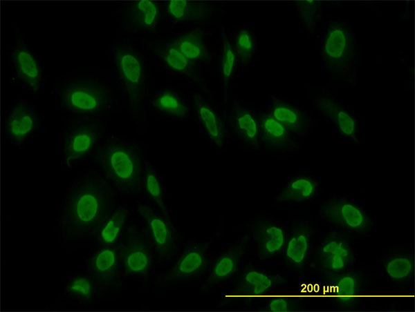 Immunofluorescence of monoclonal antibody to TAF11 on HeLa cell. [antibody concentration 10 ug/ml]