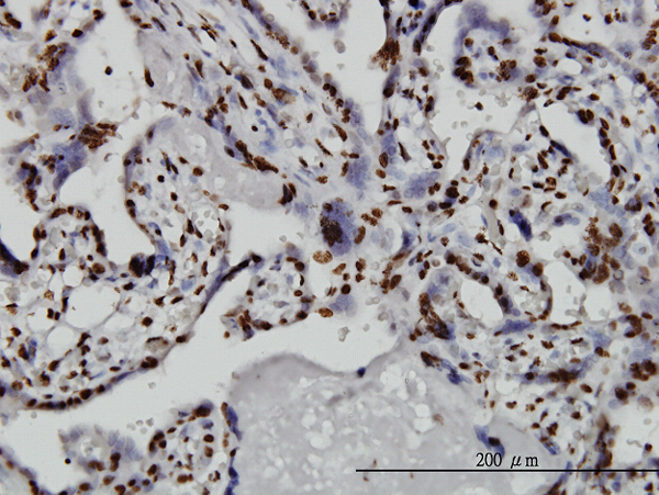Immunoperoxidase of monoclonal antibody to TAF11 on formalin-fixed paraffin-embedded human placenta. [antibody concentration 3 ug/ml]