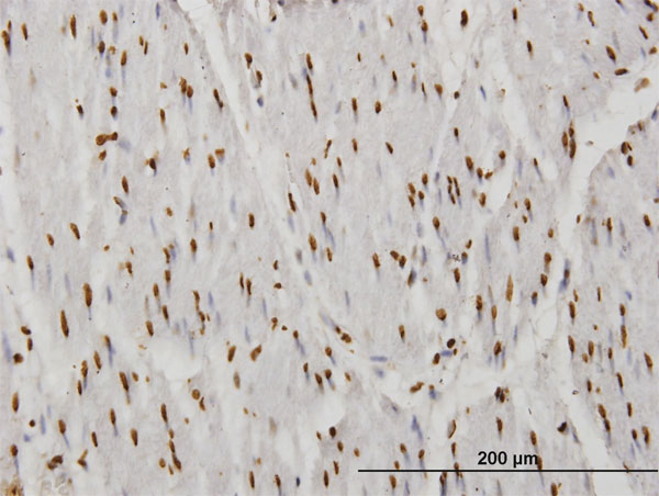 Immunoperoxidase of monoclonal antibody to TAF11 on formalin-fixed paraffin-embedded human smooth muscle. [antibody concentration 1.2 ug/ml]