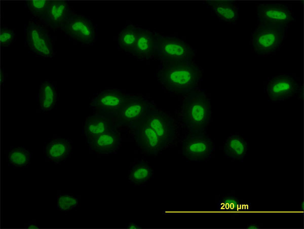 Immunofluorescence of monoclonal antibody to TAF11 on HeLa cell. [antibody concentration 10 ug/ml]