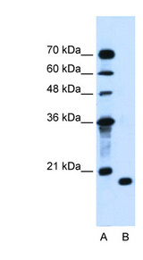 PTRH2 antibody LS-C40494 Western blot of Jurkat lysate.