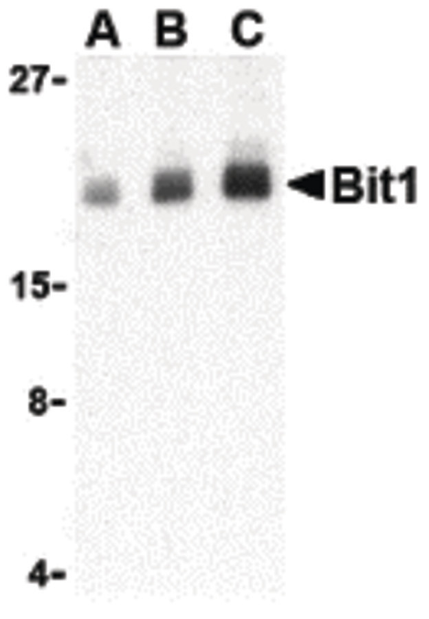Western blot of Bit1 in Daudi cell lysate with Bit1 antibody at (A) 1, (B) 2, and (C) 4 ug/ml.