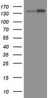 HEK293T cells were transfected with the pCMV6-ENTRY control (Left lane) or pCMV6-ENTRY TAF2 (Right lane) cDNA for 48 hrs and lysed. Equivalent amounts of cell lysates (5 ug per lane) were separated by SDS-PAGE and immunoblotted with anti-TAF2.