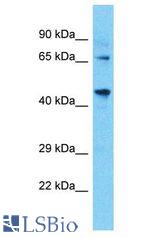 TAF4B antibody Western Blot of COLO205. Antibody dilution: 1 ug/ml.