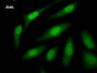 Immunostaining analysis in HeLa cells. HeLa cells were fixed with 4% paraformaldehyde and permeabilized with 0.1% Triton X-100 in PBS. The cells were immunostained with anti-TAF4B mAb.