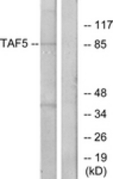 Western blot of extracts from A549 cells, using TAF5 Antibody. The lane on the right is treated with the synthesized peptide.