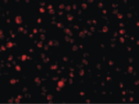 Immunofluorescence of Bit1 in 3T3 cells with Bit1 antibody at 20 ug/ml.