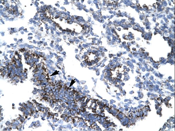 TAF7 antibody LS-C30833 was used in IHC to stain formalin-fixed, paraffin-embedded human lung.