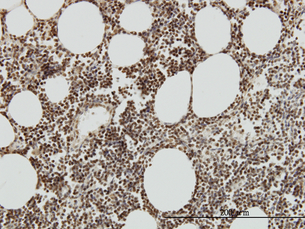 Immunoperoxidase of monoclonal antibody to TAF7 on formalin-fixed paraffin-embedded human lymph node. [antibody concentration 3 ug/ml]