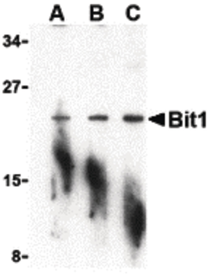 Western blot of Bit1 in A-20 cell lysate with Bit1 antibody at (A) 1, (B) 2, and (C) 4 ug/ml.