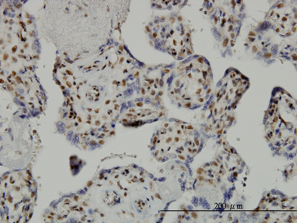 Immunoperoxidase of monoclonal antibody to TAF7 on formalin-fixed paraffin-embedded human placenta. [antibody concentration 1 ug/ml]