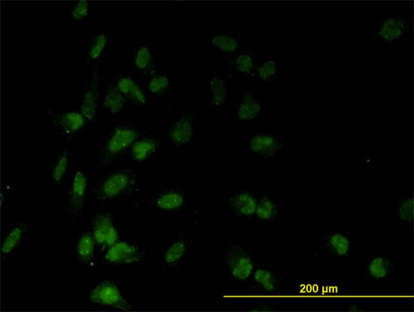 Immunofluorescence of monoclonal antibody to TAF7 on HeLa cell. [antibody concentration 10 ug/ml]