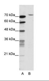 A: Marker, B: HepG2 Cell Lysate