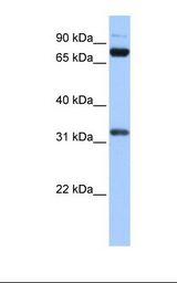 Transfected 293T cell lysate. Antibody concentration: 1.0 ug/ml. Gel concentration: 12%.