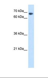 Transfected 293T cell lysate. Antibody concentration: 1.25 ug/ml. Gel concentration: 12%.