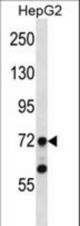 TAF6 Antibody western blot of HepG2 cell line lysates (35 ug/lane). The TAF6 antibody detected the TAF6 protein (arrow).