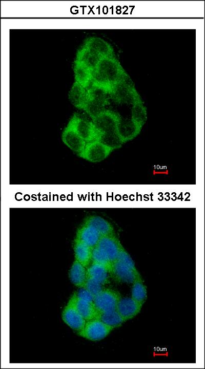 Immunofluorescence of methanol-fixed HepG2, using MIA3 antibody at 1:200 dilution.