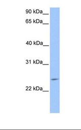 HepG2 cell lysate. Antibody concentration: 1.0 ug/ml. Gel concentration: 12%.
