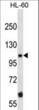 Mouse Taok2 Antibody western blot of HL-60 cell line lysates (35 ug/lane). The Taok2 antibody detected the Taok2 protein (arrow).