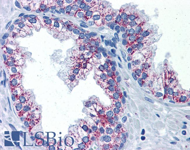 Anti-TAOK2 antibody IHC of human prostate. Immunohistochemistry of formalin-fixed, paraffin-embedded tissue after heat-induced antigen retrieval. Antibody LS-B4484 concentration 5 ug/ml.