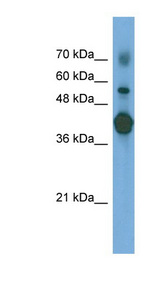 PTX3 antibody LS-C117225 Western blot of Transfected 293T cell lysate.