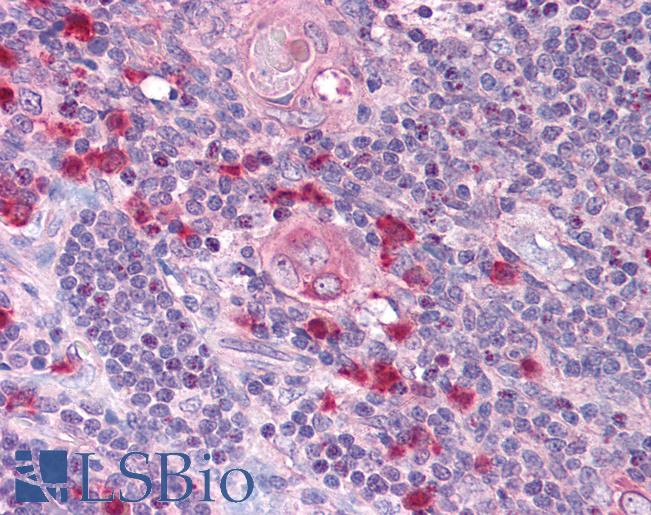 Anti-TAP2 antibody IHC of human thymus. Immunohistochemistry of formalin-fixed, paraffin-embedded tissue after heat-induced antigen retrieval. Antibody LS-B907 concentration 10 ug/ml.