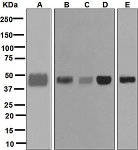 Western blot analysis on (A) HL-60 treated with Dexamethasone, (B) HL-60, (C) human spleen, (D) NIH/3T3, and (E) HUVEC lysates using anti-PTX3 antibody.