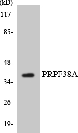 Western blot of the lysates from HUVEC cells using PRPF38A antibody.