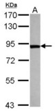 Sample (30 ug of whole cell lysate) A: HeLa 7.5% SDS PAGE TARS antibody diluted at 1:2000