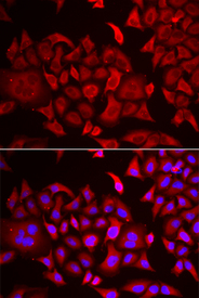 Immunofluorescence analysis of HeLa cell using TARS antibody. Blue: DAPI for nuclear staining.